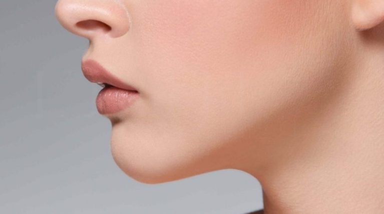 Masseter (Çene Botoksu) Masseter (Çene Botoksu)