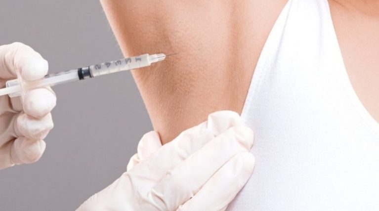 Terleme Tedavisi (Hiperhidroz Botoksu) kıbrıs Terleme Tedavisi (Hiperhidroz Botoksu) kıbrıs