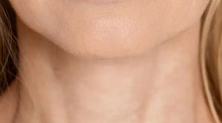 boyun-botox-kibris boyun-botox-kibris